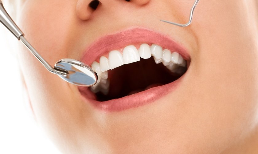 Dental Transformation